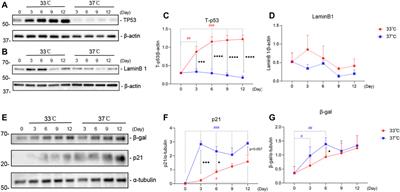 A Human Conditionally Immortalized Proximal Tubule Epithelial Cell Line as a Novel Model for Studying Senescence and Response to Senolytics